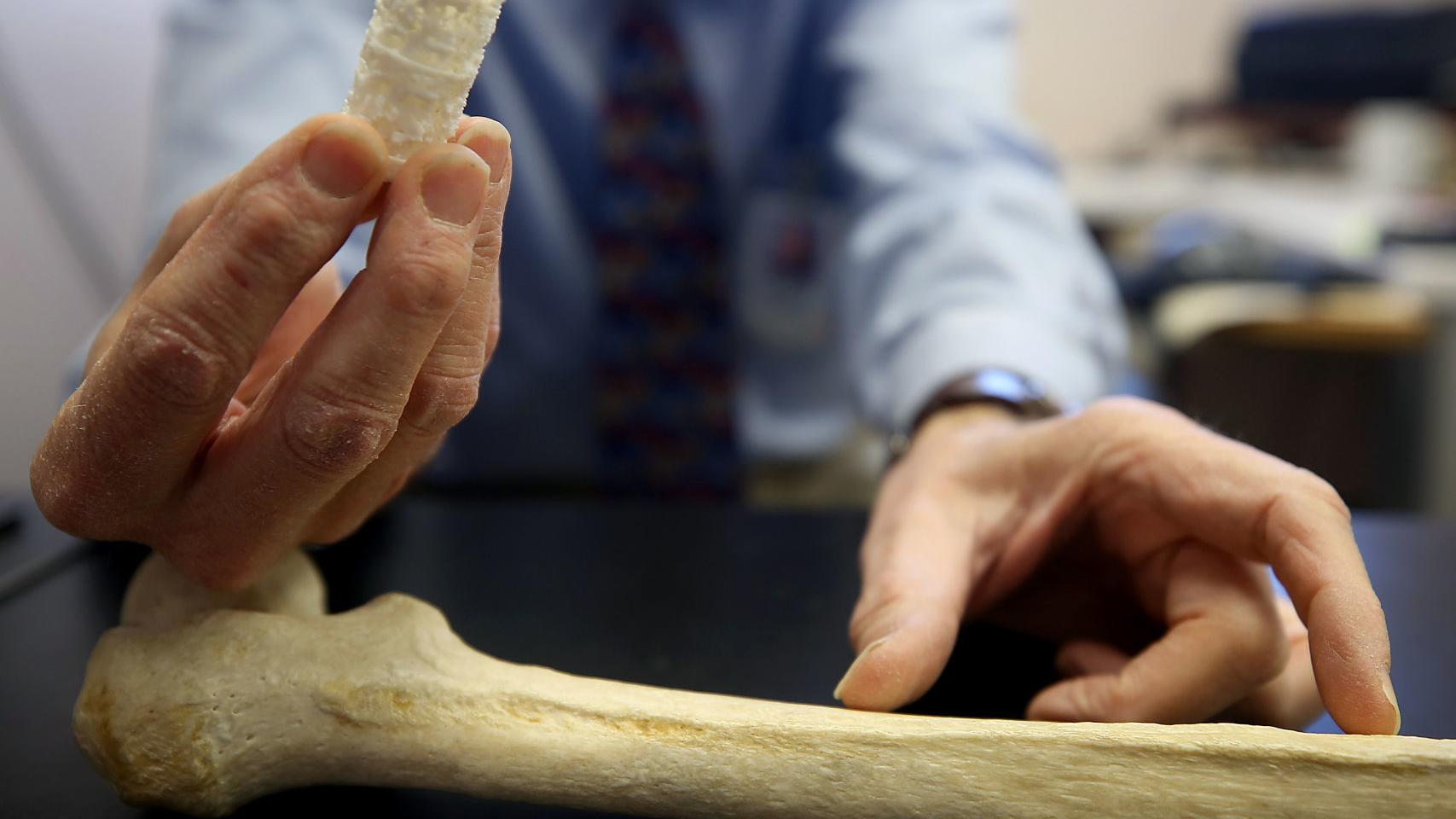 Military grant helping UA researchers develop better ways to regrow damaged bones